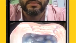 لایو مشترک دکتر علوی نژاد و دکتر زینالی