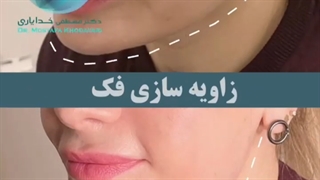 فیلم زاویه سازی فک