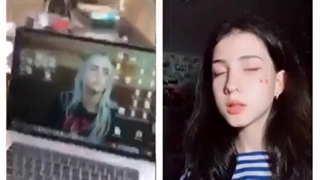 بی تی اس یا بیلی ایلیش