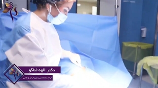 وجود سینه فرعی در خانم ها