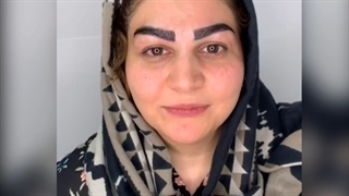 نمونه ای کاشت ابرو طبیعی
