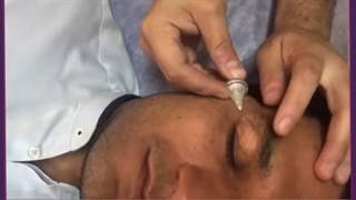 هزینه و مزایای شگفت انگیز کربوکسی تراپی