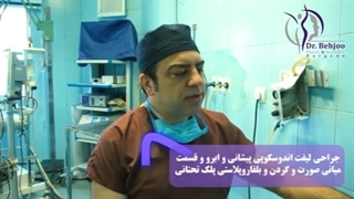 جراحی لیفت اندوسکوپی پیشانی و ابرو همراه با بلفاروپلاستی قسمت دوم