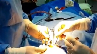 فیلم واقعی جراحی زیبایی بینی