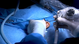 عمل جراحی اندوسکوپی گوش در بیمارستان رضوی