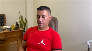 نتیجه جراحی رینوپلاستی بعد از یک هفته