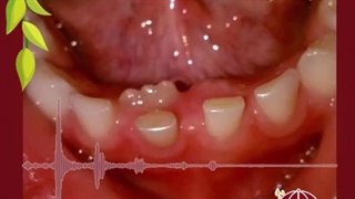 مزایا ارتودنسی پیشگیری| دکتر ماریتا شکاریان