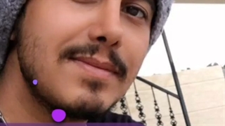 نمونه جراحی بینی پس از 8 سال