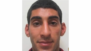 نمونه جراحی زیبایی اتوپلاستی (جراحی گوش)