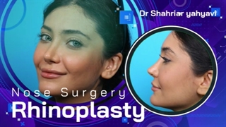 نمونه های جراحی زیبایی بینی | دکتر یحیوی
