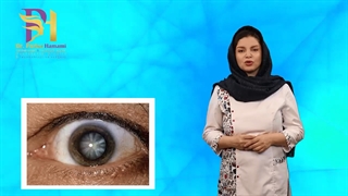 چرا ما دچار آب مروارید میشیم و چگونه می توان پیشگیری کرد؟