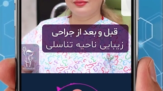 قبل و بعد جراحی زیبایی ناحیه تناسلی