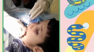 فیلم واقعی دندانپزشکی اطفال