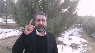 نکته کلیدی و بسیار مهم. دکتر بهروز شهسواری ترمیم زیبایی دندان
