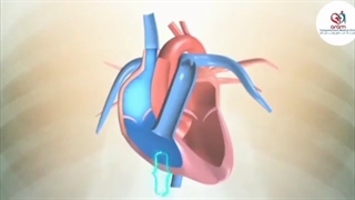 قلـب چگـونه کار میکنـد؟!