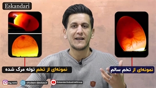 چهار مدل تخمی که در نطفه سنجی باید بشناسید (قسمت دوم)