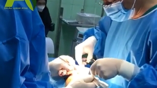 جراحی زیبایی بینی