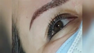 فیبروز ابرو مخصوص مبارزان سرطان