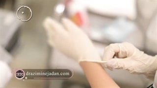 میکرونیدلینگ برای پوست بدن چه فایده‌ای دارد ؟ ترمیم لبخند لثه‌ای