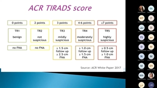 سخنرانی دکتر چگینی و دکتر زارعی در مورد ندول تیروئید - قسمت دوم
