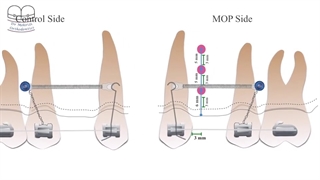 ارتودنسی سریع 3 | دکتر احسان ابوئی مهریزی