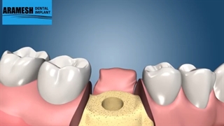 دندانپزشکی آرامش