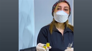 فیلم توضیحات در رابطه با مزایای پی آر پی