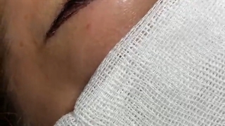 لایو کاشت ابرو