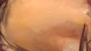 جرمگیری دندان زیبایی