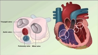بیماری دریچه های قلب | دکتر یاسمین افسری متخصص قلب و عروق