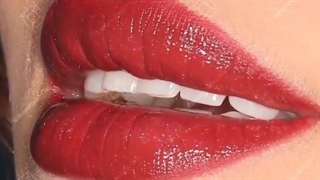 تزریق ژل لب طبیعی و نچرال در کلینیک جردن