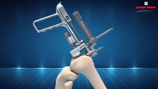 تعویض مفصل زانو در شیراز