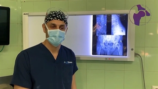 تعویض مفصل موفق ران بعد از فلج اطفال در کودکی | دکتر کتوه قرنی زاده