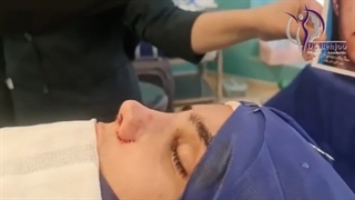 جراحی زیبایی بینی