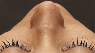 فیلم عمل زیبایی بینی