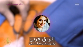 مراقبتهای بعد از تزریق چربی کاشت مو