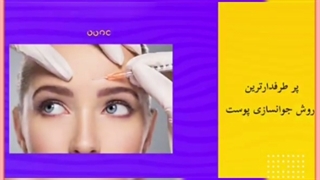 تزریق بوتاکس دور چشم/هزینه،عوارض ، مزایا و مراقبت ها