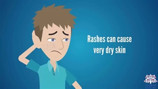 اگزما چیست و راه های درمان آن به چه صورت است؟