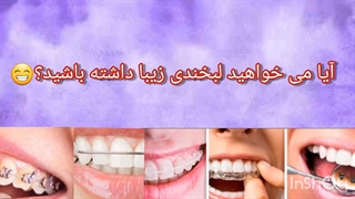 ارتودنسی دندان در کلینیک قلهک