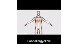 سرکوب کردن سیستم ایمنی بدن