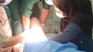 جا انداختن لگن به روش آلیس