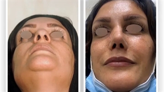 فیلم اتاق عمل جراحی بینی مدل نیمه فانتزی