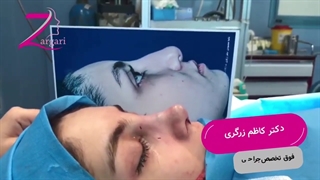 فیلم جراحی بینی نیمه فانتزی