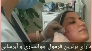 جوانسازی پوست صورت با لیزر آر آف فرکشنال
