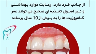 ماندگاری کامپوزیت