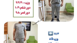 ساده ترین راه لاغری ترمیم دندان