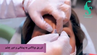 فیلم واقعی تزریق بوتاکس به پیشانی و دور چشم لیزر موهای زائد