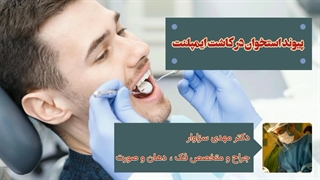 پیوند استخوان در کاشت ایمپلنت