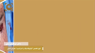 جراحی برداشتن توده بدخیم در پلک تحتانی متصل به گونه