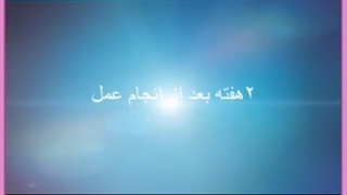 هزینه،معایب و مزایای کاشت مو به روش سوپر ترکیبی